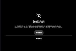露骨！慎入！范德彪小拇指的骨头直接刺出来了！